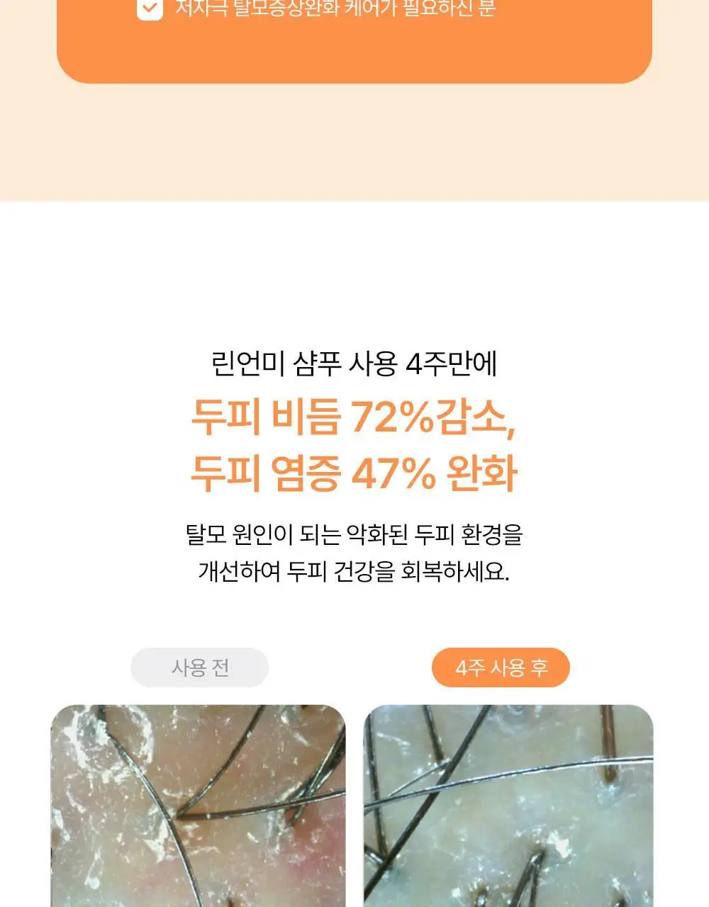 [맞춤형 탈모샴푸] 위드비컨 두피 코렉팅 샴푸 360ml(두피별 샴푸) 상세페이지 49
